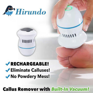 Hirundo Foot File and Callus Remover